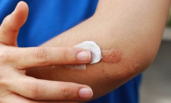 Khám phá những công dụng thú vị của kem đánh răng