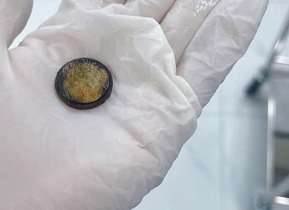 Gắp dị vật pin cúc áo trong thực quản bệnh nhi. Ảnh BVCC Gắp dị vật pin cúc áo trong thực quản bệnh nhi. Ảnh BVCC