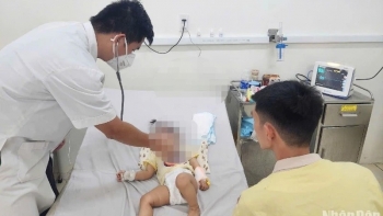 Đà Nẵng ghi nhận 300 trường hợp từ chối tiêm vắc xin sởi