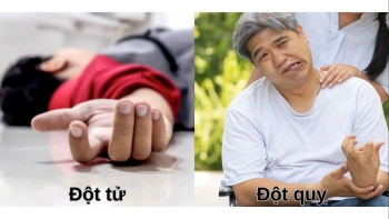 Phân biệt đột quỵ và đột tử