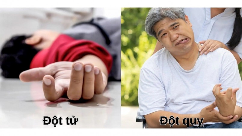 Phân biệt đột quỵ và đột tử