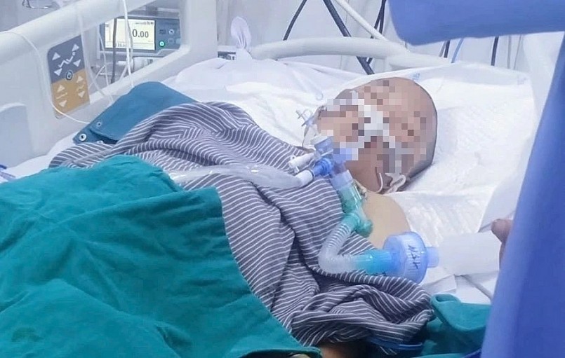 Anh Dương vẫn đang hôn mê, được các bác sĩ điều trị  ẢNH: H.S