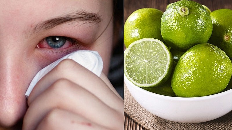 Nhỏ chanh vào mắt là sai lầm nghiêm trọng gây hại thị lực