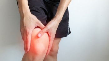 Bác sĩ chia sẻ bí kíp kiểm soát viêm khớp