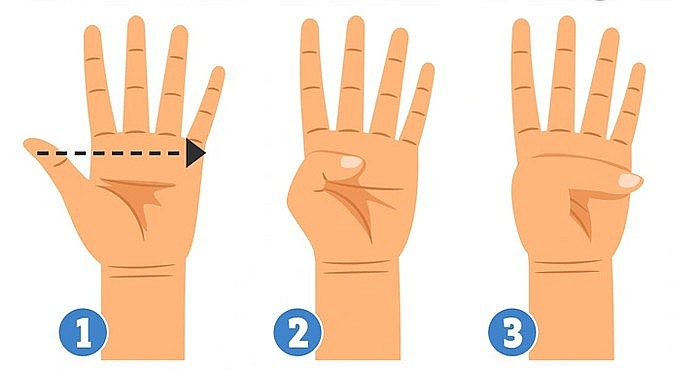 Người có thể gập ngón cái như hình 3 cho thấy nguy cơ bị phình động mạch chủ. Ảnh: The Sun