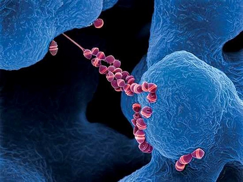 Vi khuẩn liên cầu lợn lây từ lợn sang người thông qua tiếp xúc trực tiếp với lợn mang vi khuẩn