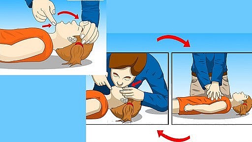 Thực hiện hồi sức tim phổi (CPR) ngay lập tức nếu nạn nhân bất tỉnh, không thở