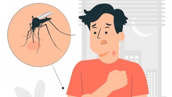 Phòng dịch bệnh ngày mưa bão