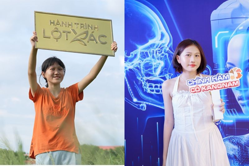 Hành trình Lột xác: Một thập kỷ kiến tạo vẻ đẹp và thay đổi số phận