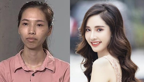 Hành trình Lột xác: Một thập kỷ kiến tạo vẻ đẹp và thay đổi số phận