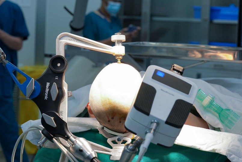 Cánh tay Robot AutoGuide giúp bác sĩ đặt điện cực vào nội sọ được chính xác và nhanh chóng