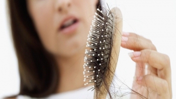 Giải mã nguyên nhân và dấu hiệu sớm của rụng tóc từng mảng