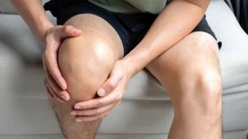 Vì sao bệnh gút ngày càng “trẻ hóa”?