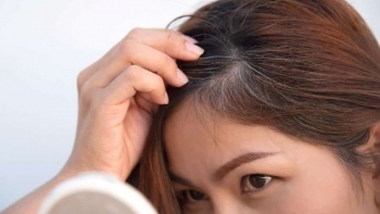 Giải mã nguyên nhân tóc bạc sớm