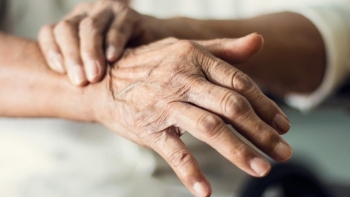 Nhận diện khiếm khuyết vận động ở người bệnh Parkinson