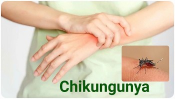 Bộ Y tế bác tin đồn Việt Nam có ca Chikungunya