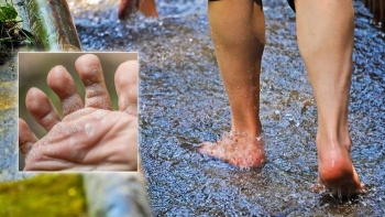 Phát hiện sớm và phòng ngừa bệnh ngoài da mùa mưa lũ