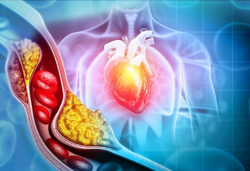 Vắc-xin zona không chỉ ngăn ngừa tái phát virus VZV mà còn giúp giảm đáng kể nguy cơ đột quỵ và nhồi máu cơ tim.