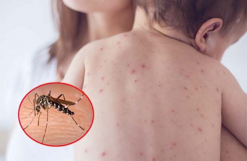 Chỉ riêng trong tháng 10, cả nước đã ghi nhận 24.250 trường hợp mắc sốt xuất huyết, trong đó có 6 ca tử vong.