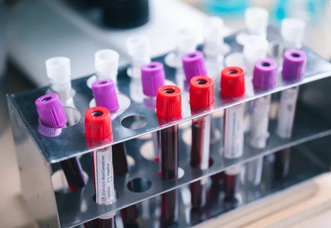 Bộ Y tế ước tính, nếu việc liên thông giúp giảm được chỉ 1% số xét nghiệm phải thực hiện lại, mỗi năm các bệnh viện sẽ giảm được khoảng 4,75 triệu lượt xét nghiệm. 