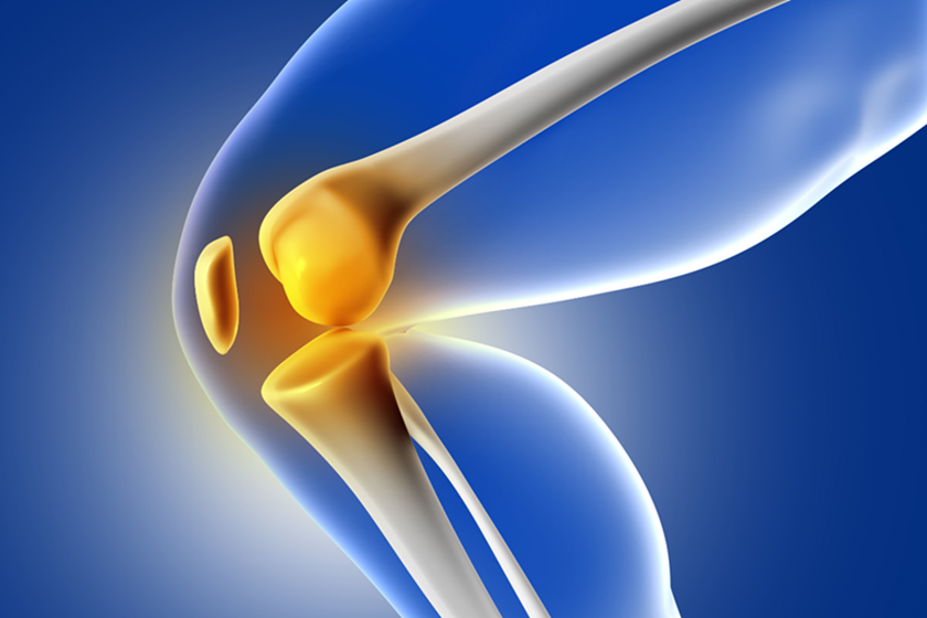 Thoái hóa khớp nếu không được điều trị hiệu quả có thể gây biến dạng khớp, làm tăng nguy phải thay khớp (Ảnh: Freepik.com)