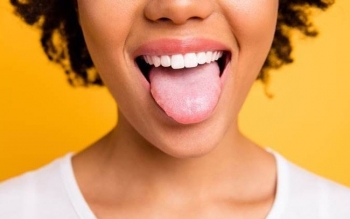 Nhận biết một số loại bệnh thông qua lưỡi của bạn