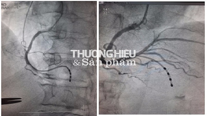 BỆNH VIỆN HỮU NGHỊ ĐA KHOA NGHỆ AN THỰC HIỆN NHIỀU KỸ THUẬT CAO ĐỂ CỨU SỐNG BỆNH NHÂN TRONG ĐẠI DỊCH COVID 19