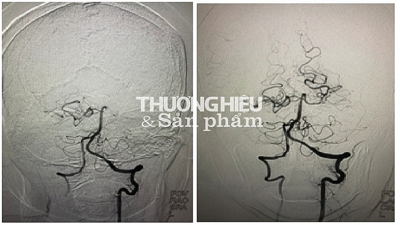 BỆNH VIỆN HỮU NGHỊ ĐA KHOA NGHỆ AN THỰC HIỆN NHIỀU KỸ THUẬT CAO ĐỂ CỨU SỐNG BỆNH NHÂN TRONG ĐẠI DỊCH COVID 19