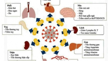 Bệnh nhân từng mắc COVID-19 có thể chịu đựng tới 203 di chứng