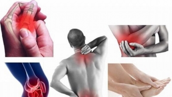 Hàng loạt thảo dược “dân dã” hỗ trợ điều trị xương khớp