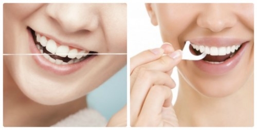 Chỉ nha khoa phải dùng thế nào cho đúng? Chỉ nha khoa phải dùng thế nào cho đúng?