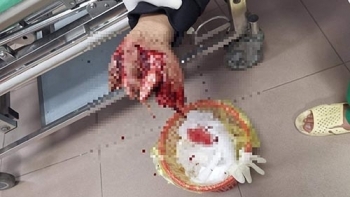 Gần Tết, pháo nổ lại đe dọa người dân