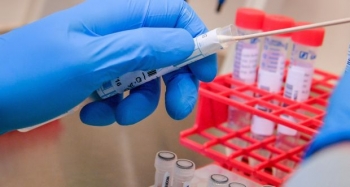 Các nhà khoa học tìm ra phương pháp mới trong điều trị COVID-19