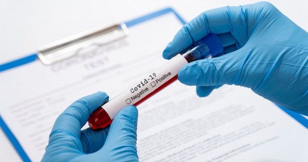 Việt Nam hiện đã có 118 phòng xét nghiệm COVID-19